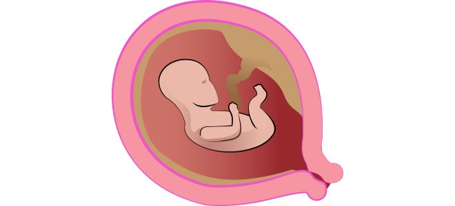 Illustration of the baby's development inside the uterus at week 7 of pregnancy.