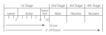 Diagram of the 4 stages of childbirth.