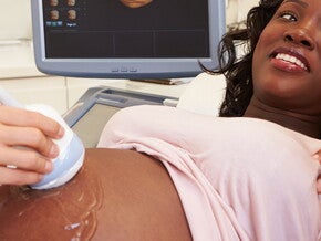 Prenatal Care Prenatal Care