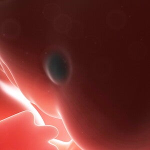 First trimester First trimester