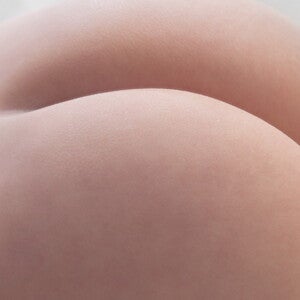 Rashes