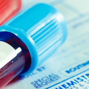 Screening tests