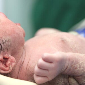 The Apgar score