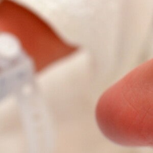 Your baby’s appearance at birth