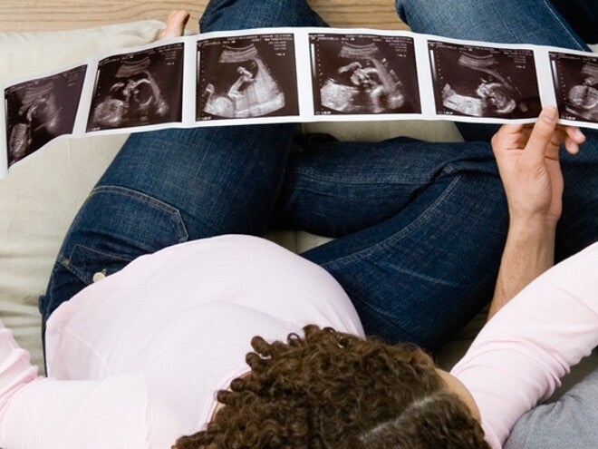 Questions to ask at your 12-week scan Questions to ask at your 12-week scan