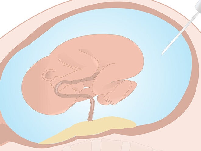 Diagnostic tests Diagnostic tests