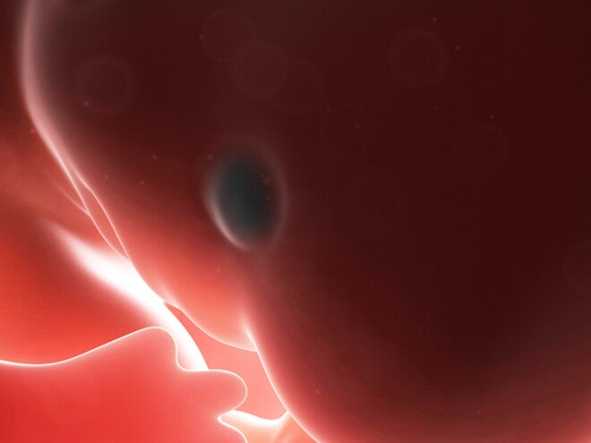 First trimester First trimester