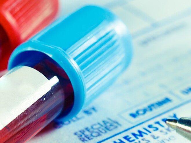 Screening tests Screening tests